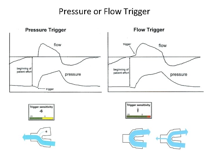 Pressure or Flow Trigger 