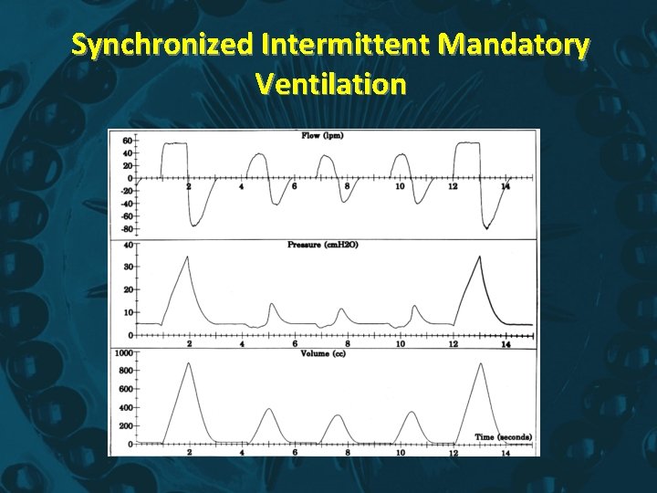 Synchronized Intermittent Mandatory Ventilation 