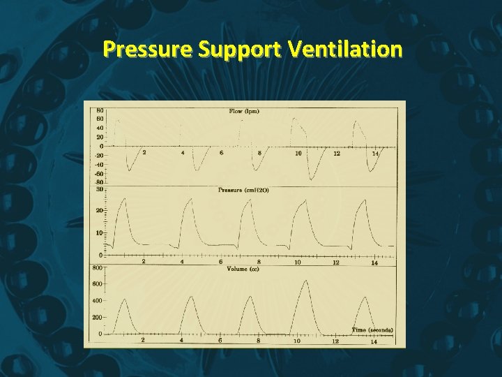 Pressure Support Ventilation 