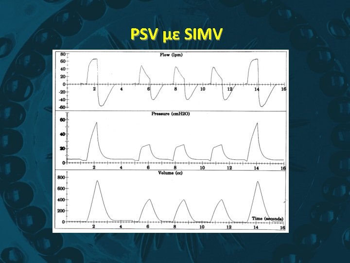 PSV με SIMV 