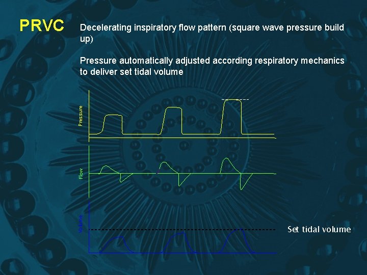 Decelerating inspiratory flow pattern (square wave pressure build up) Flow Pressure automatically adjusted according