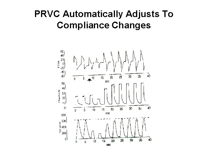 PRVC Automatically Adjusts To Compliance Changes 