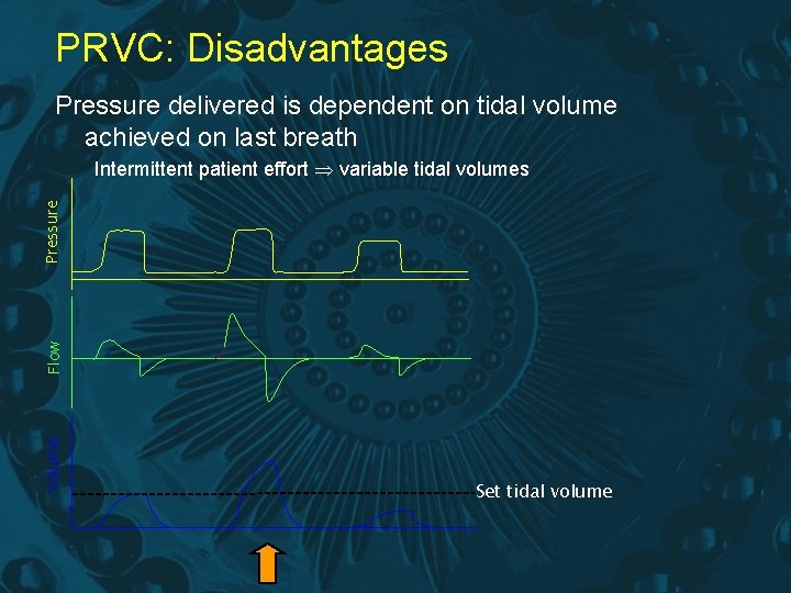 PRVC: Disadvantages Pressure delivered is dependent on tidal volume achieved on last breath Volume