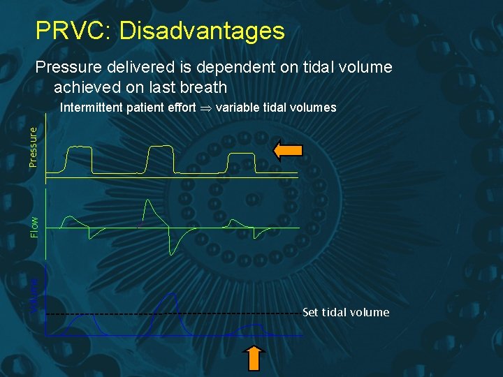PRVC: Disadvantages Pressure delivered is dependent on tidal volume achieved on last breath Volume