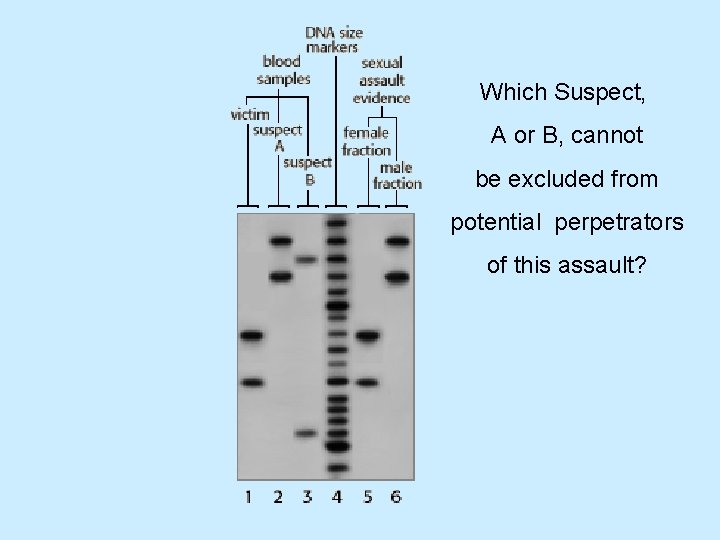 Which Suspect, A or B, cannot be excluded from potential perpetrators of this assault?