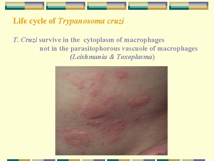 Life cycle of Trypanosoma cruzi T. Cruzi survive in the cytoplasm of macrophages not