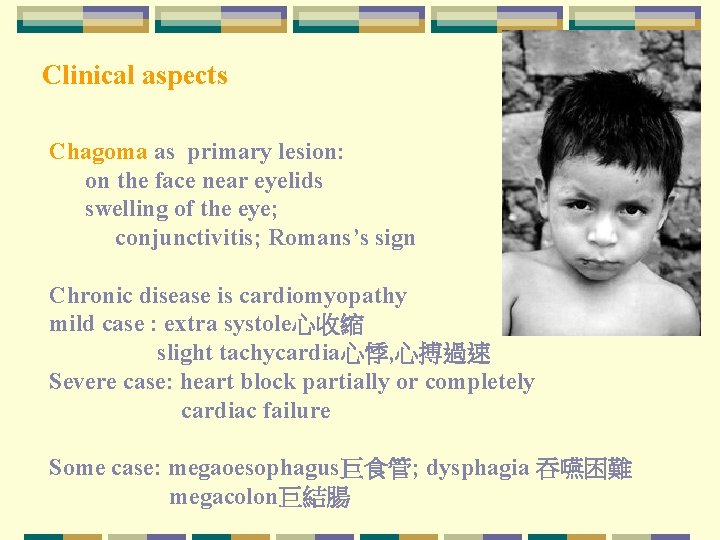 Clinical aspects Chagoma as primary lesion: on the face near eyelids swelling of the Clinical aspects Chagoma as primary lesion: on the face near eyelids swelling of the