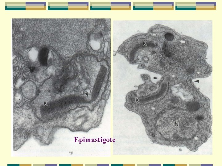 Epimastigote Epimastigote