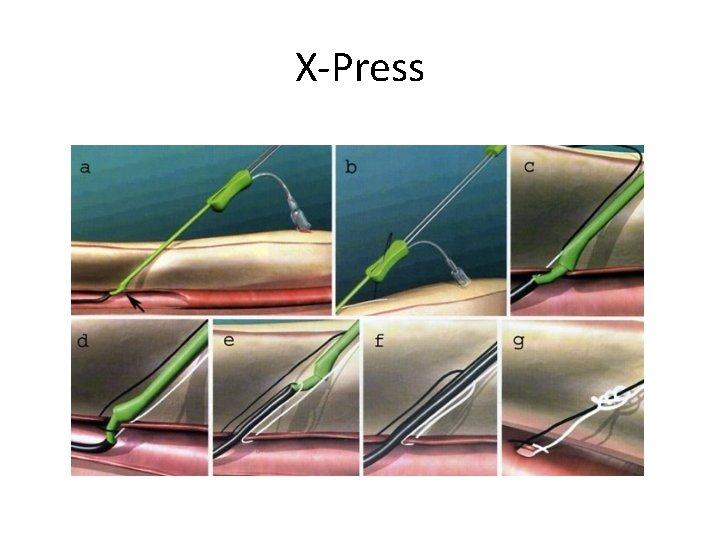 X-Press X-Press