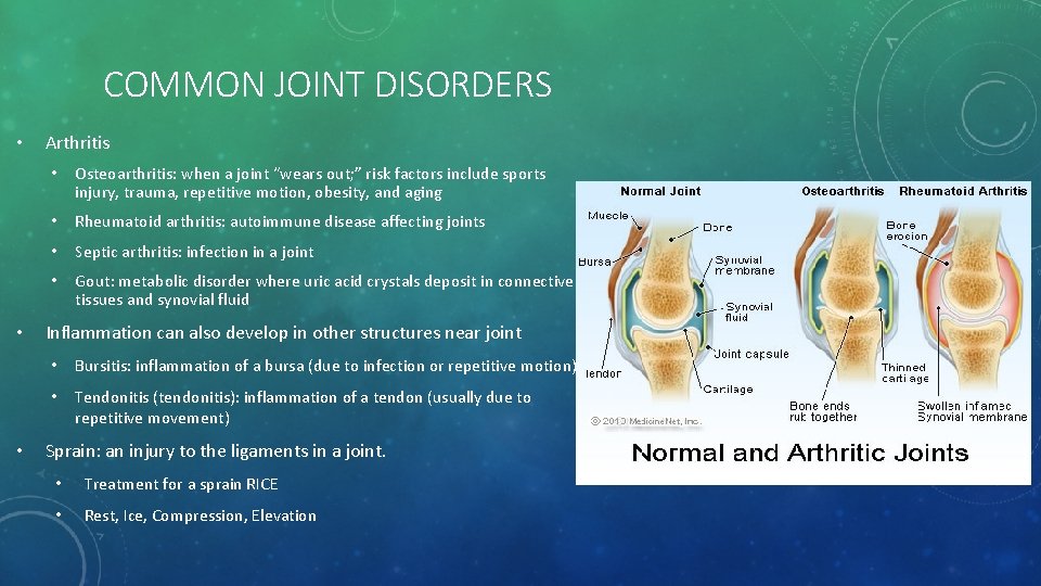 COMMON JOINT DISORDERS • • • Arthritis • Osteoarthritis: when a joint “wears out;