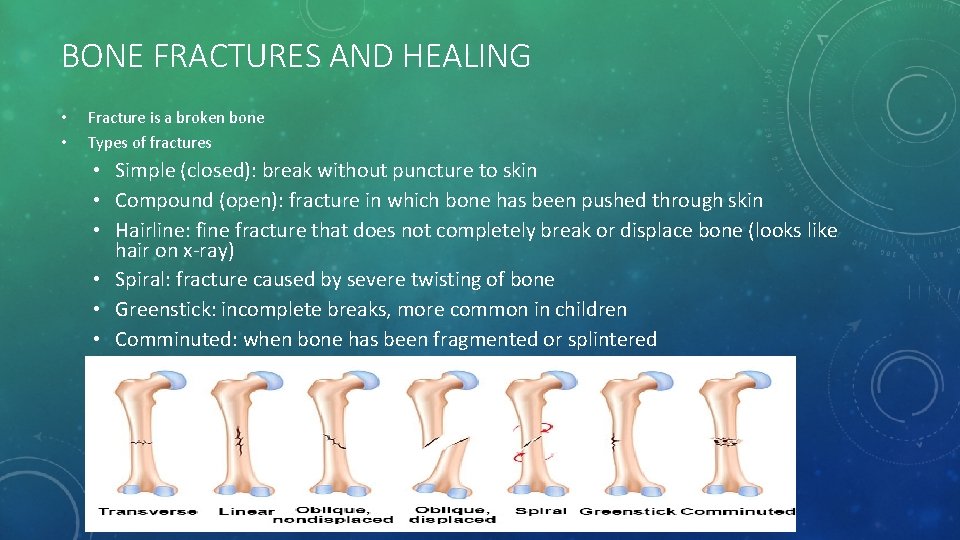 BONE FRACTURES AND HEALING • • Fracture is a broken bone Types of fractures
