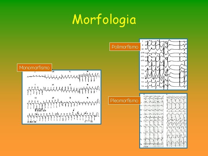 Morfologia Polimorfismo Monomorfismo Pleomorfismo Morfologia Polimorfismo Monomorfismo Pleomorfismo