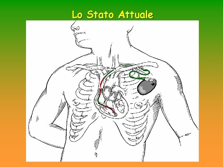 Lo Stato Attuale Lo Stato Attuale