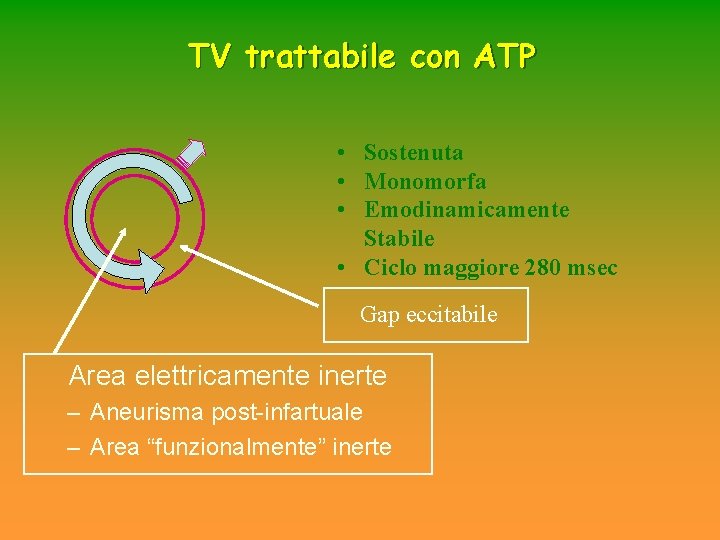 TV trattabile con ATP • Sostenuta • Monomorfa • Emodinamicamente Stabile • Ciclo maggiore TV trattabile con ATP • Sostenuta • Monomorfa • Emodinamicamente Stabile • Ciclo maggiore