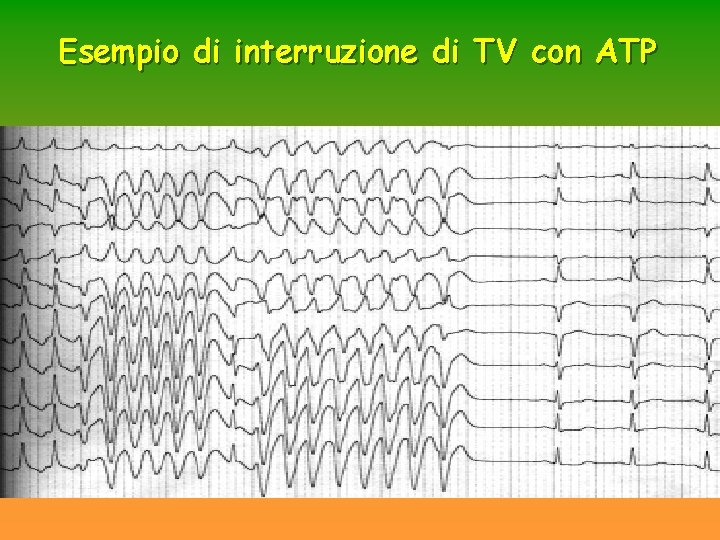 Esempio di interruzione di TV con ATP Esempio di interruzione di TV con ATP