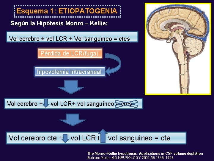 Esquema 1: ETIOPATOGENIA Según la Hipótesis Monro – Kellie: Vol cerebro + vol LCR