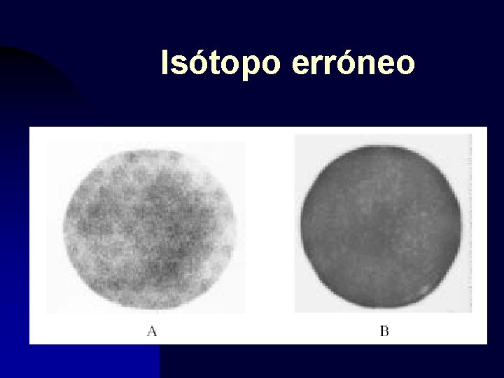 Isótopo erróneo 