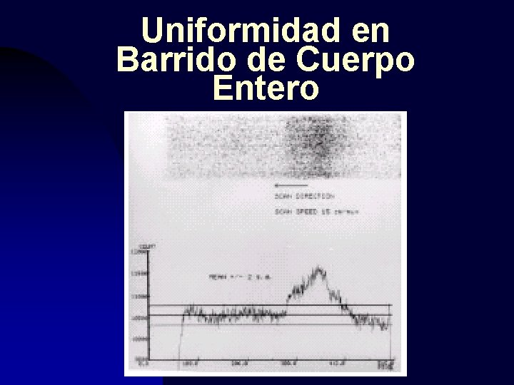 Uniformidad en Barrido de Cuerpo Entero 