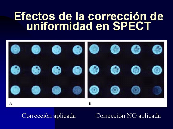 Efectos de la corrección de uniformidad en SPECT Corrección aplicada Corrección NO aplicada 
