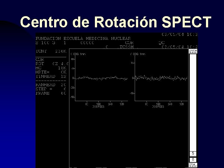 Centro de Rotación SPECT 