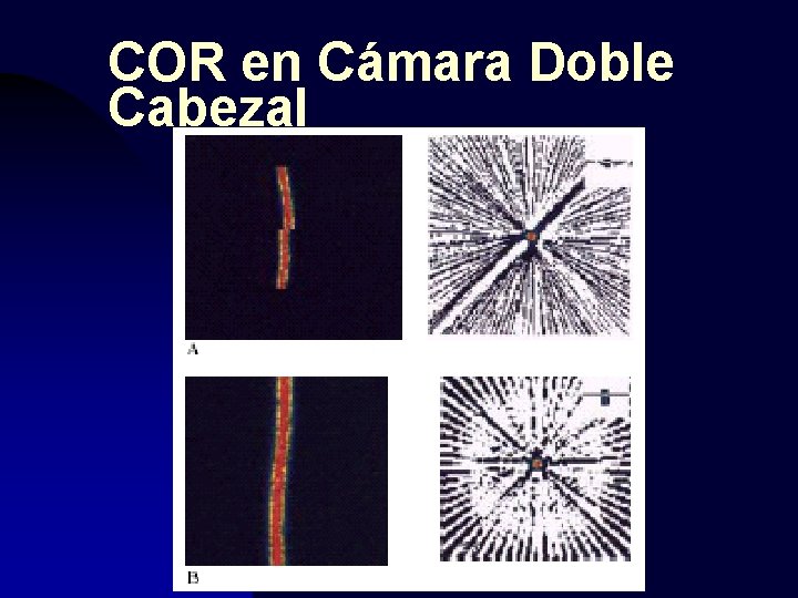 COR en Cámara Doble Cabezal 