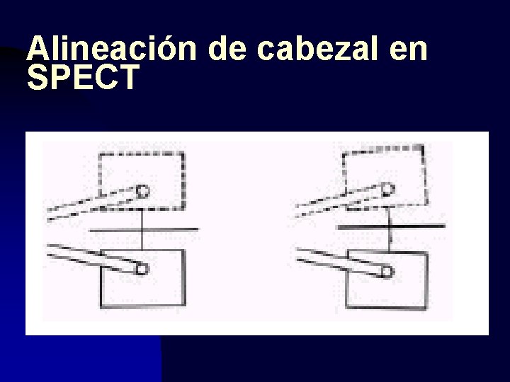 Alineación de cabezal en SPECT 