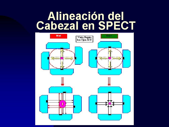 Alineación del Cabezal en SPECT 