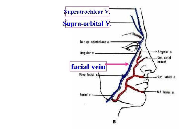 Supratrochlear V. Supra-orbital V. facial vein 