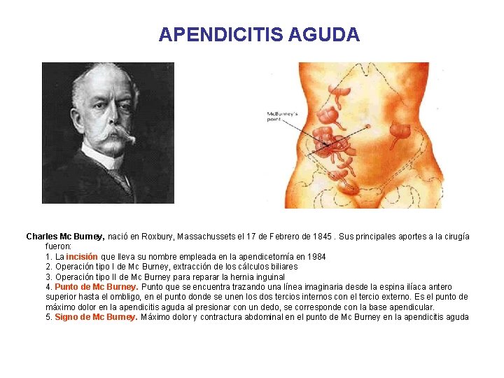 APENDICITIS AGUDA Charles Mc Burney, nació en Roxbury, Massachussets el 17 de Febrero de