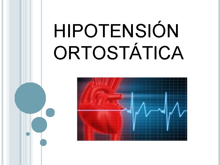 HIPOTENSIÓN ORTOSTÁTICA 