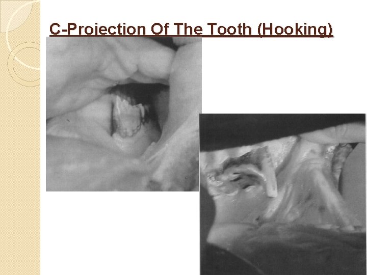 C-Projection Of The Tooth (Hooking) 