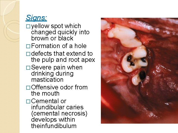 Signs: � yellow spot which changed quickly into brown or black � Formation of