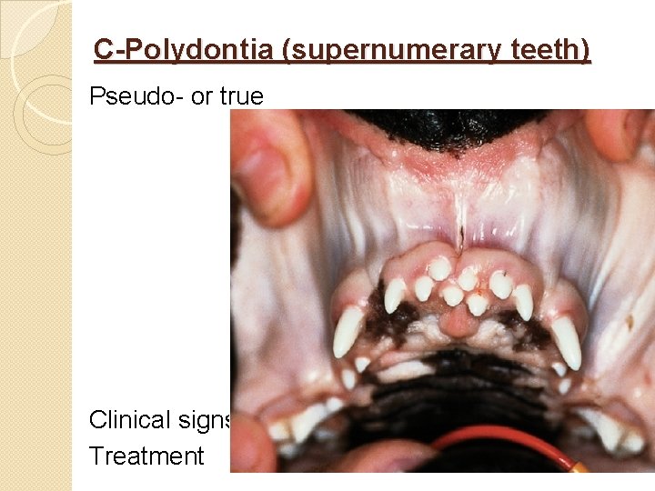 C-Polydontia (supernumerary teeth) Pseudo- or true Clinical signs Treatment 