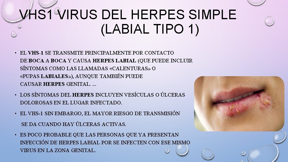 VHS 1 VIRUS DEL HERPES SIMPLE (LABIAL TIPO 1) • EL VHS-1 SE TRANSMITE