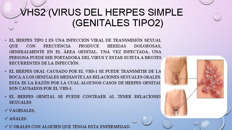 VHS 2 (VIRUS DEL HERPES SIMPLE (GENITALES TIPO 2) • EL HERPES TIPO 2