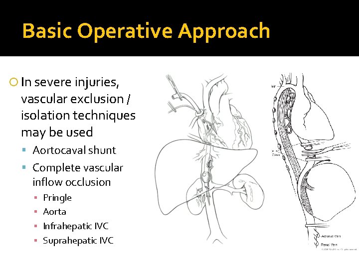 Basic Operative Approach In severe injuries, vascular exclusion / isolation techniques may be used