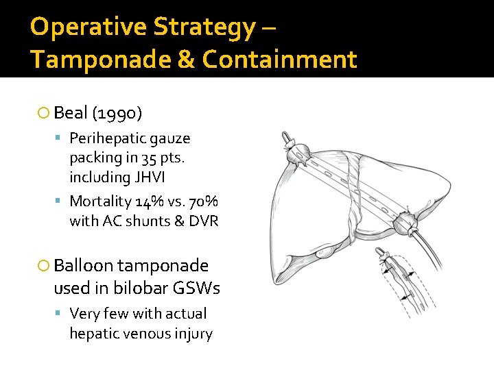 Operative Strategy – Tamponade & Containment Beal (1990) Perihepatic gauze packing in 35 pts.