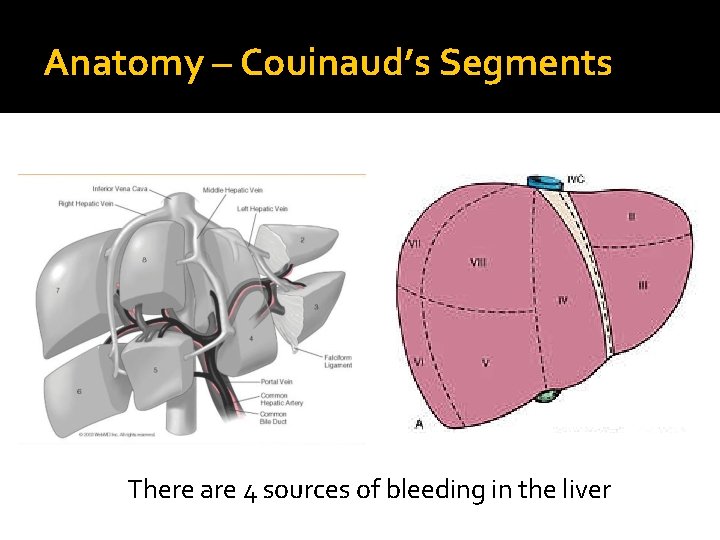 Anatomy – Couinaud’s Segments There are 4 sources of bleeding in the liver 