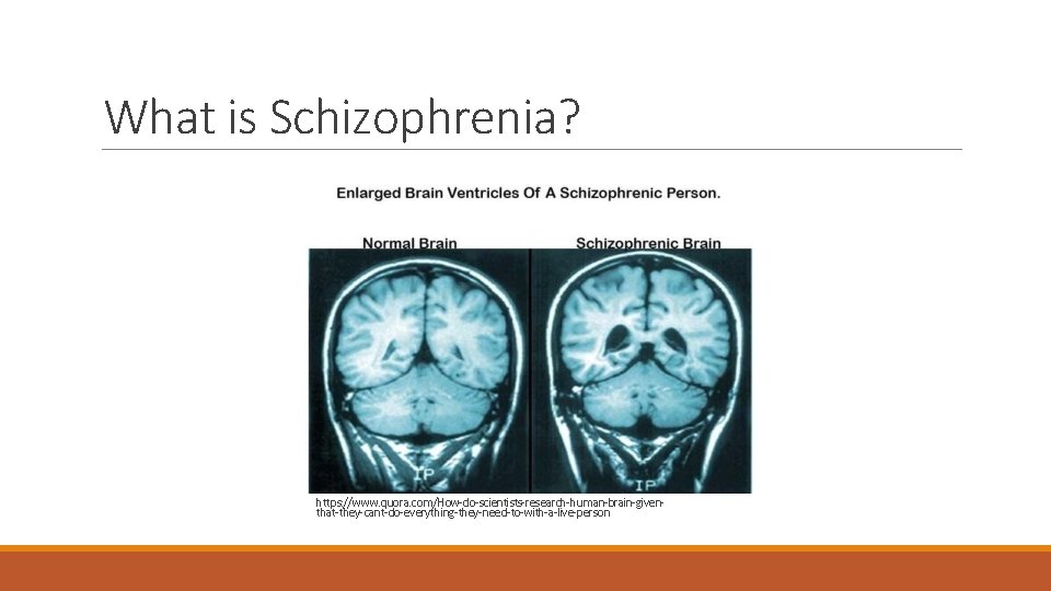 What is Schizophrenia? https: //www. quora. com/How-do-scientists-research-human-brain-giventhat-they-cant-do-everything-they-need-to-with-a-live-person 