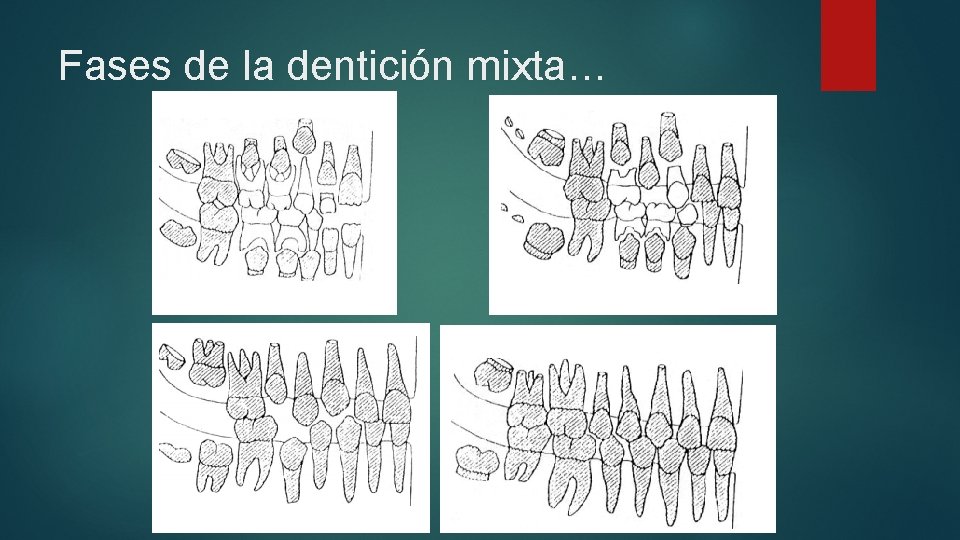 Fases de la dentición mixta… 