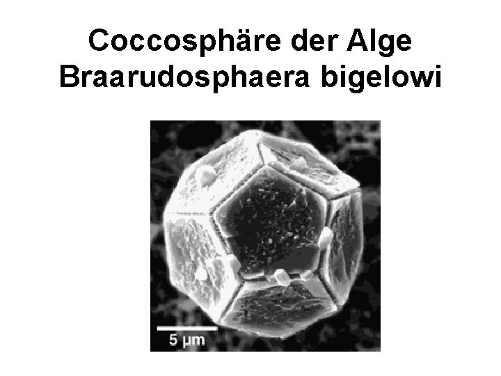 Coccosphäre der Alge Braarudosphaera bigelowi 