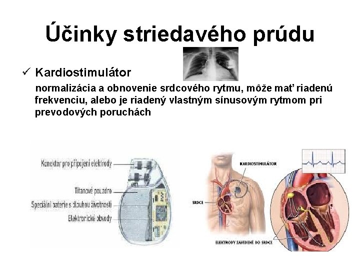 Účinky striedavého prúdu ü Kardiostimulátor normalizácia a obnovenie srdcového rytmu, môže mať riadenú frekvenciu,