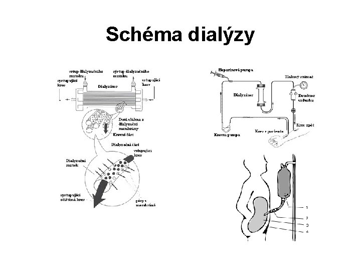 Schéma dialýzy 