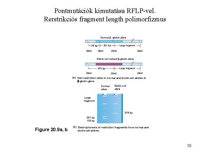 Pontmutációk kimutatása RFLP-vel. Rerstrikciós fragment length polimorfizmus Normal -globin allele 201 bp 175 bp