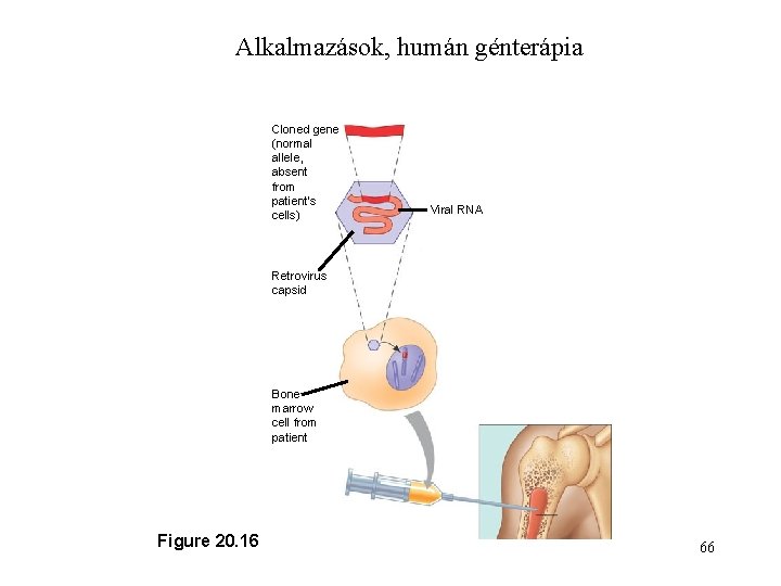 Alkalmazások, humán génterápia Cloned gene (normal allele, absent from patient’s cells) Viral RNA 2