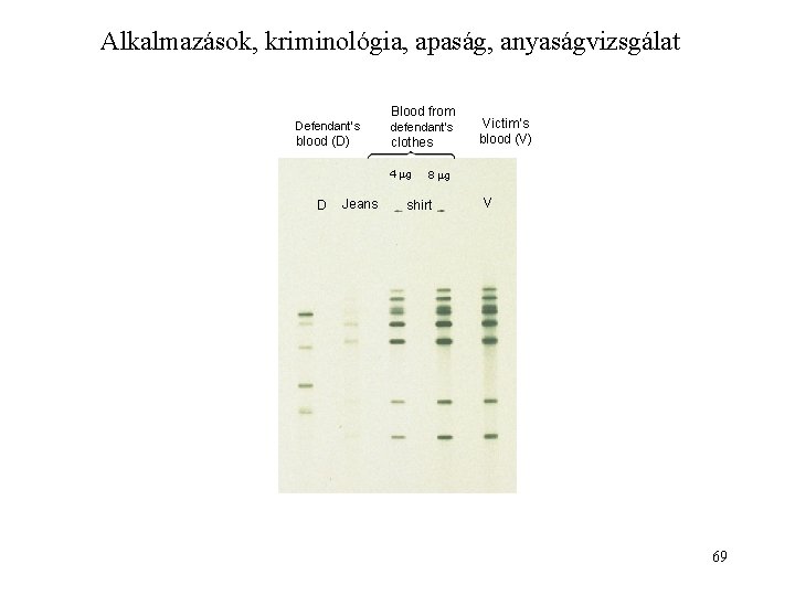 Alkalmazások, kriminológia, apaság, anyaságvizsgálat Defendant’s blood (D) Blood from defendant’s clothes 4 g D