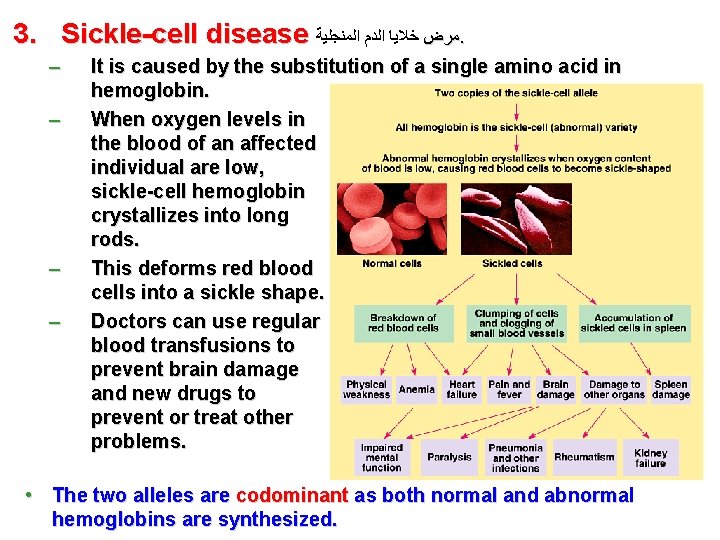 3. Sickle-cell disease ﻣﺮﺽ ﺧﻼﻳﺎ ﺍﻟﺪﻡ ﺍﻟﻤﻨﺠﻠﻴﺔ. – – It is caused by the