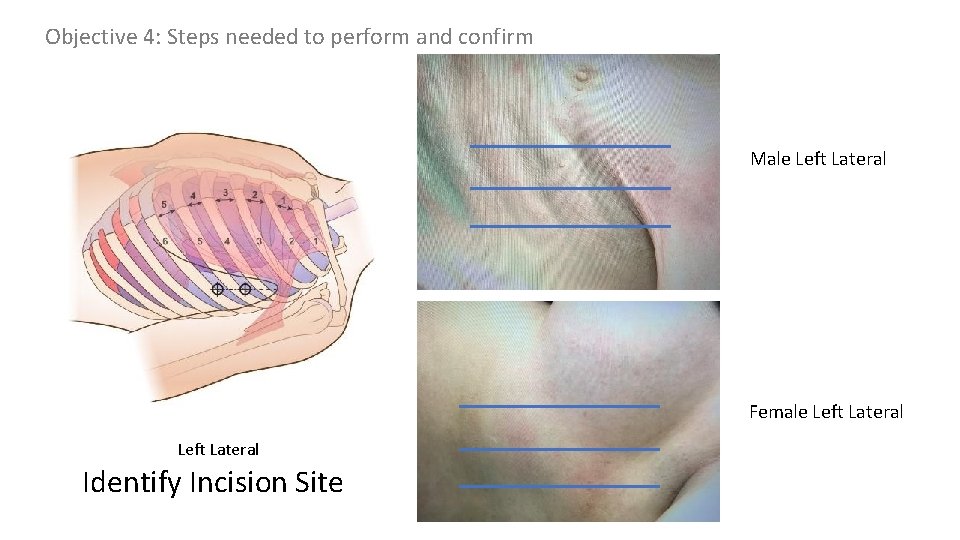 Objective 4: Steps needed to perform and confirm Male Left Lateral Female Left Lateral Objective 4: Steps needed to perform and confirm Male Left Lateral Female Left Lateral