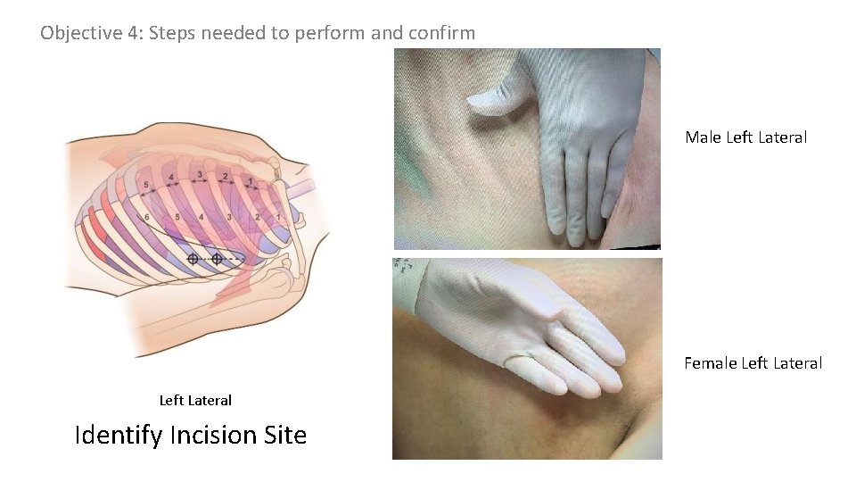 Objective 4: Steps needed to perform and confirm Male Left Lateral Female Left Lateral Objective 4: Steps needed to perform and confirm Male Left Lateral Female Left Lateral