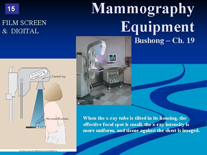 15 FILM SCREEN & DIGITAL Mammography Equipment Bushong – Ch. 19 When the x-ray